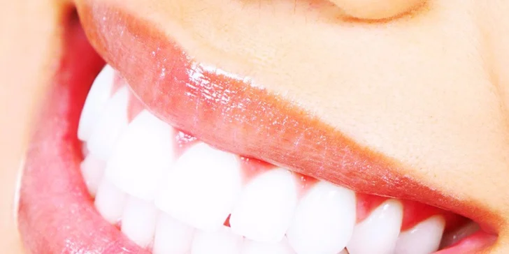 Profesionálna dentálna hygiena
