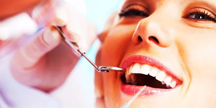 Profesionálna dentálna hygiena