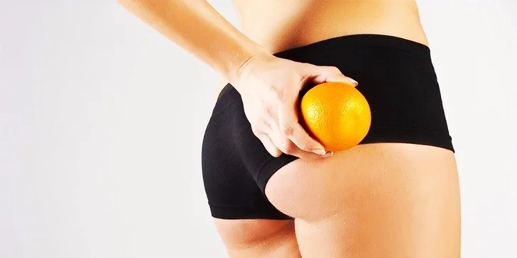 Laserová liposukcia s lymfodrenážou
