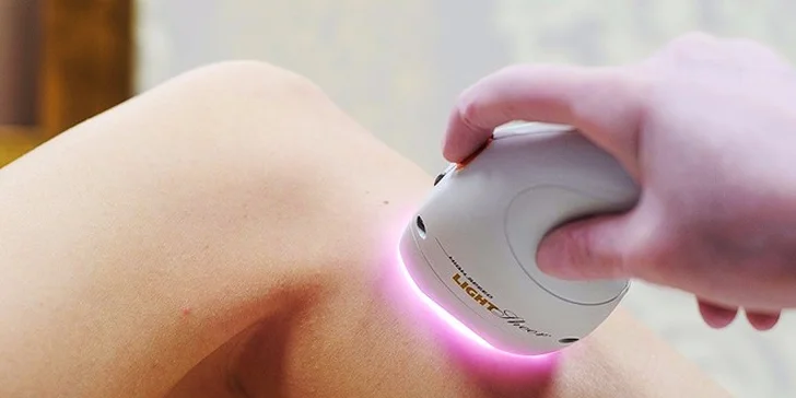 Bezbolestná epilácia diódovým laserom Lumenis LightSheer