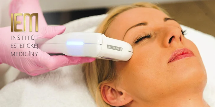 Nechirurgický facelifting čela a okolia očí s efektom nadvihnutia obočia. Omladnite Ultherapiou!