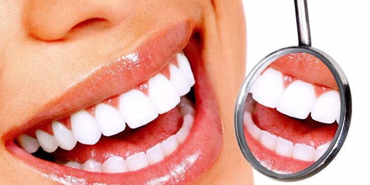 Laserové bielenie zubov za úžasnú cenu!