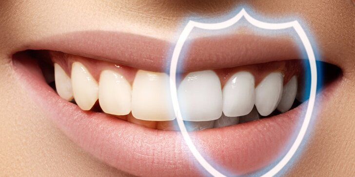 Dentálna hygiena a bielenie zubov lampou Zoom! Ako darček medzizubná kefka! Využitie až na 5 pobočkách; teraz aj v Senci!