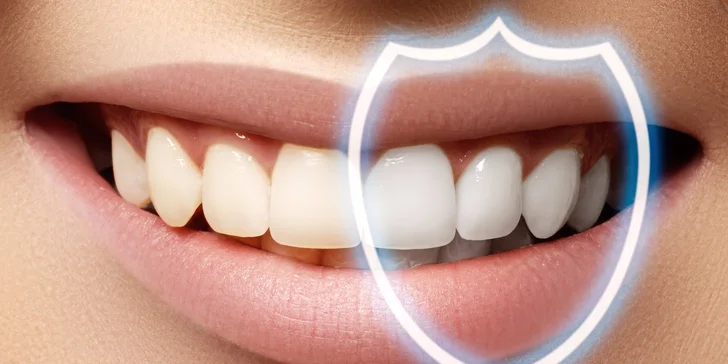 Dentálna hygiena a bielenie zubov lampou Zoom! Darček medzizubná kefka!