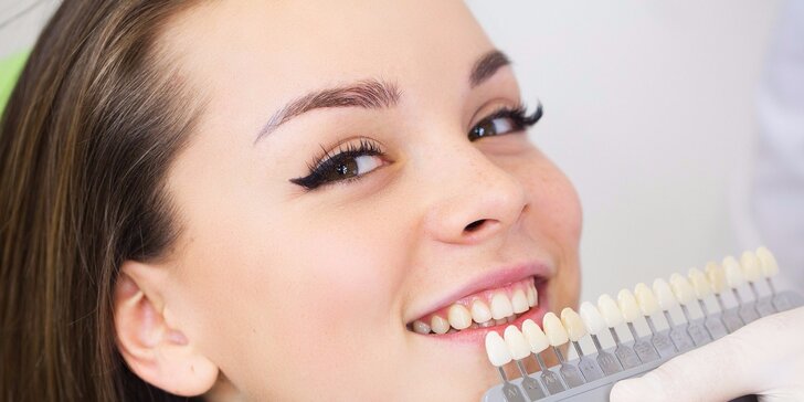Dentálna hygiena s možnosťou bielenia
