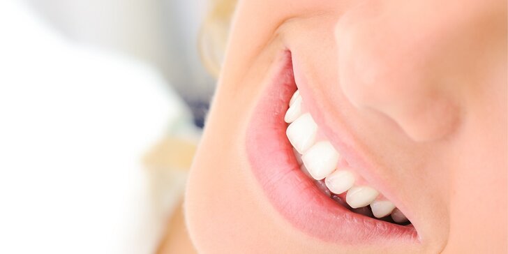 Dentálna hygiena, pieskovanie alebo bielenie zubov