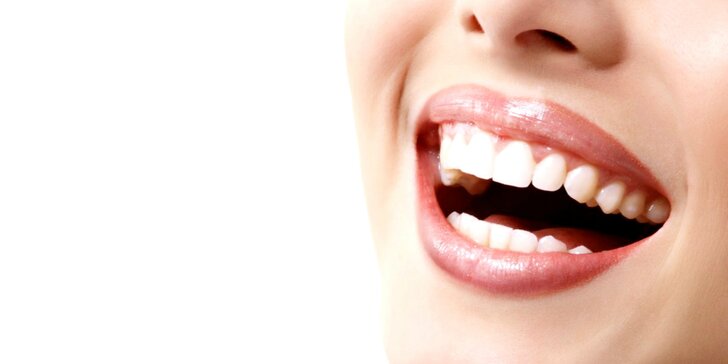 Kozmetické bielenie zubov PEARLSMILE®. 3. ošetrenie ZDARMA!