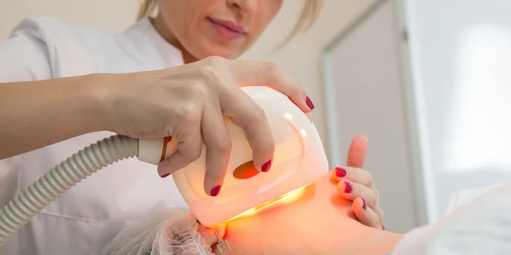 Odstránenie pigmentových škvŕn E-light metódou - Bonita Ružinov
