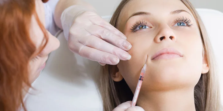 Zdvihnutie poklesnutých kútikov kyselinovu hyalurónovou v Salóne Dermafresh
