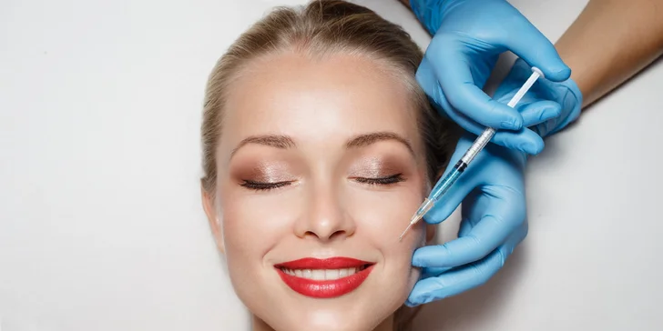 Zdvihnutie poklesnutých kútikov kyselinovu hyalurónovou v Salóne Dermafresh