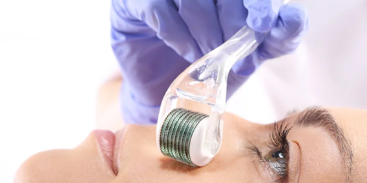 Vitamínová mezoterapia alebo mezoterapia kyselinou hyalurónovou