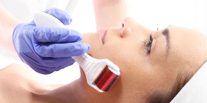 Vitamínová mezoterapia alebo mezoterapia kyselinou hyalurónovou