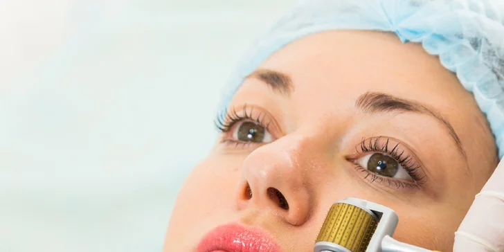 Vitamínová mezoterapia alebo mezoterapia kyselinou hyalurónovou