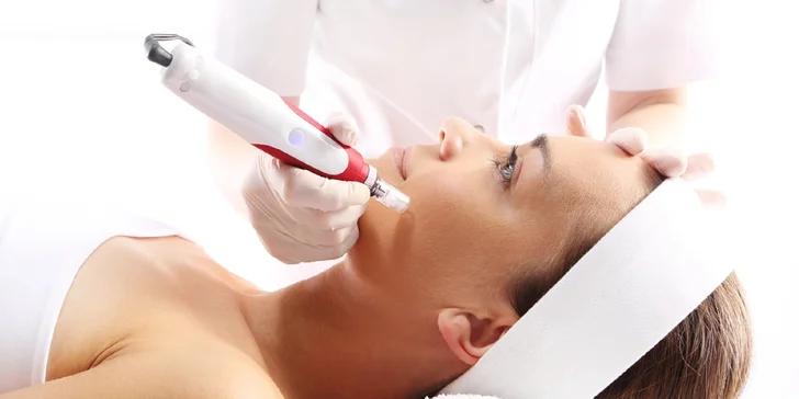 Dermabrázia a hĺbkové čistenie pleti alebo mezoterapia s kyselinou hyalurónovou