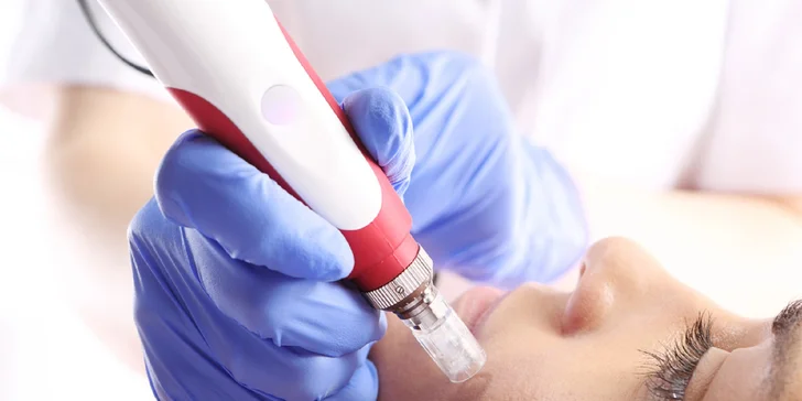 Dermabrázia a hĺbkové čistenie pleti alebo mezoterapia s kyselinou hyalurónovou