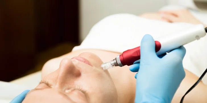 Dermabrázia a hĺbkové čistenie pleti alebo mezoterapia s kyselinou hyalurónovou