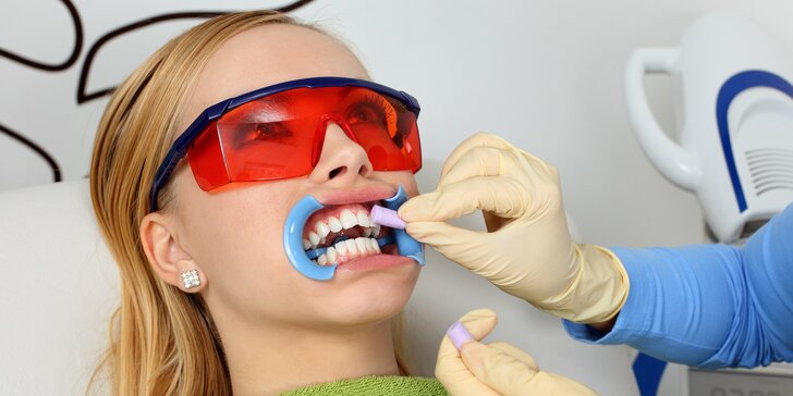 Bezperoxidové šetrné bielenie zubov systémom Smile Point