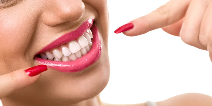 Bezperoxidové šetrné bielenie zubov systémom Smile Point
