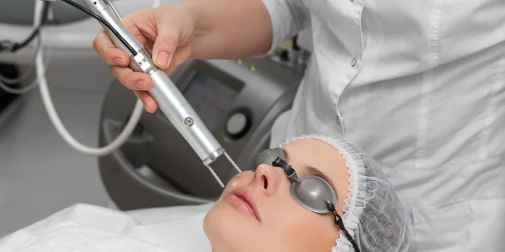 Ošetrenie CO2 resurfacing - estetická dermatológia ­zameraná na omladenie