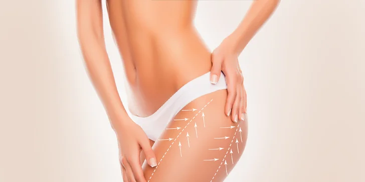 Kryolipolýza aj s wellness analýzou celého tela. Chudnutie ľadom!