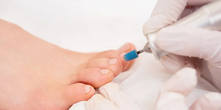 Prístrojové ošetrenie nechtov nôh s masážou chodidiel alebo suchá medicinálna pedikúra pre dámy aj pánov