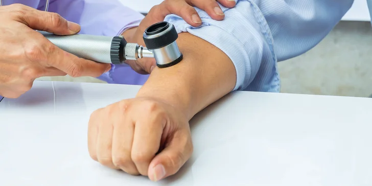 Vyšetrenie znamienok digitálnym dermatoskopom