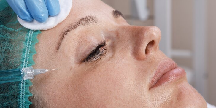 Omladenie a vyhladenie jemných vrások s mezoterapiou tváre alebo krku a dekoltu. NOVINKA: mezoterapia očného okolia alebo vlasov