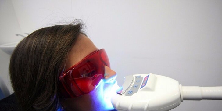 Žiarivo biely úsmev s laserovým bielením zubov