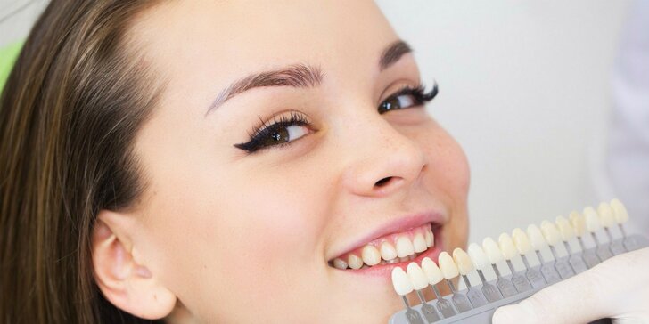 Kompletná dentálna hygiena alebo bielenie zubov