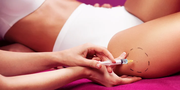 Injekčné ošetrenie celulitídy a strií mezoterapiou v Biothecare Estetika ​