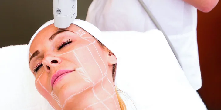 Hifu Ultherapy - Neinvazívny lifting čela, očného okolia, krku a podbradku