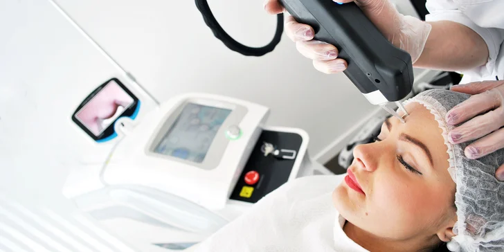 Odstránenie žiliek na nose alebo brade laserom