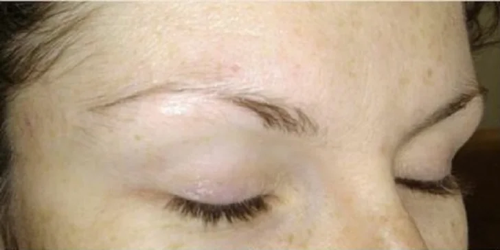 Permanentný make-up obočia alebo pier