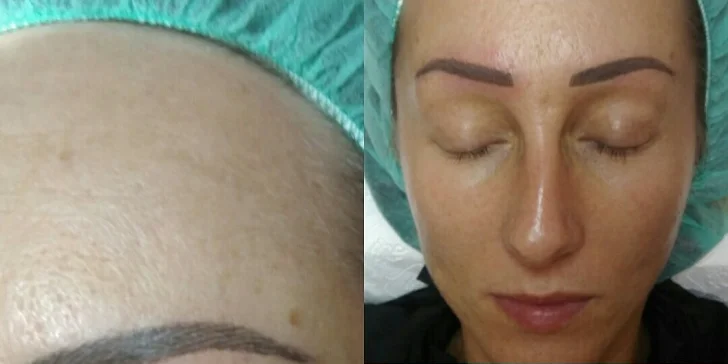 Permanentný make-up obočia alebo pier