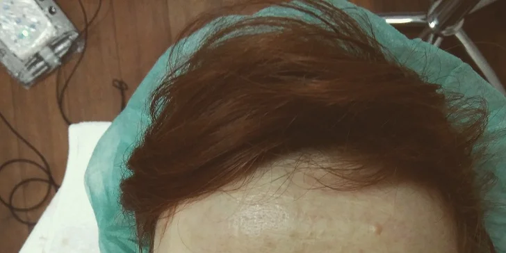 Permanentný make-up obočia alebo pier
