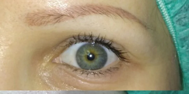 Hĺbkové čistenie pleti v Diamond face