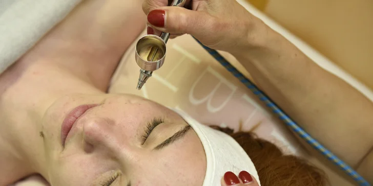 Výplň vrások kyselinou hyalurónovou, vitamínom C a rádiofrekvenciou