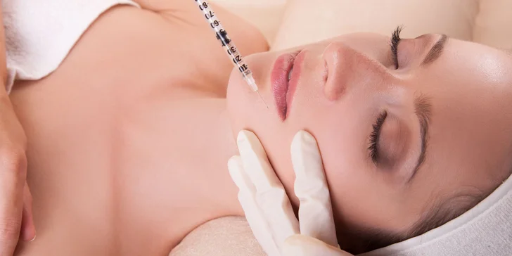 Aplikácia kyseliny hyalurónovej Princess ® VOLUME pre korekciu hlbokých vrások