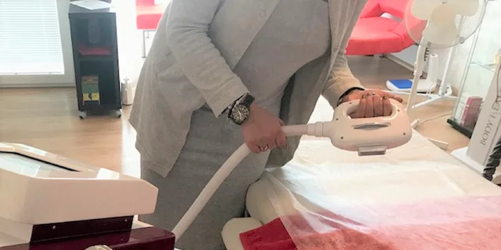 Odstránenie chĺpkov IPL metódou