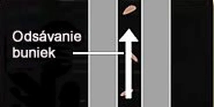 Profesionálna diamantová mikrodermabrázia
