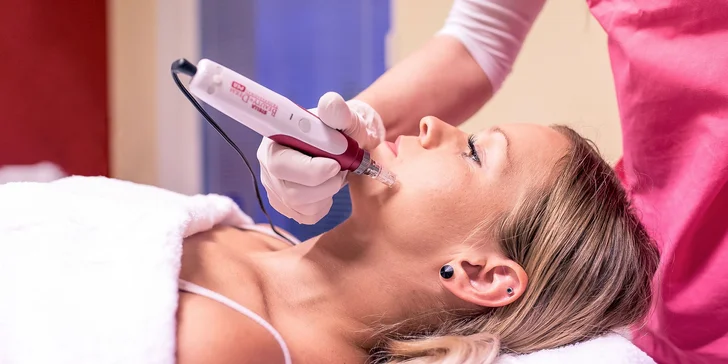 Dermabrázia, ošetrenie problematickej pleti alebo mezoterapia