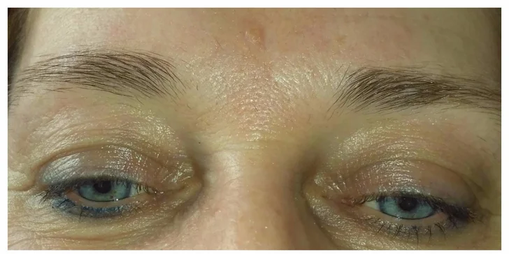 Permanentný make-up obočia alebo pier