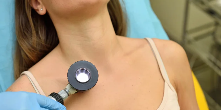 Dermatoskopické vyšetrenie znamienok v Chirkoze