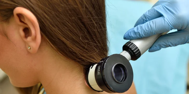 Dermatoskopické vyšetrenie znamienok v Chirkoze