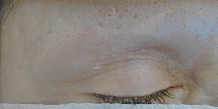 Permanentný make up obočia alebo pier