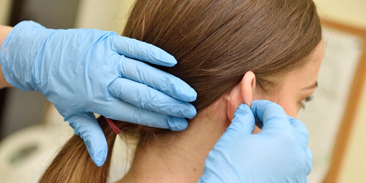 Otoplastika - korekcia uší v privátnom medicínskom centre