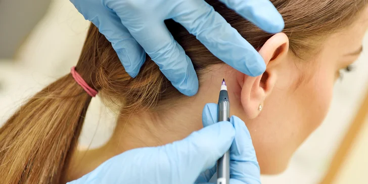 Otoplastika - korekcia uší v privátnom medicínskom centre