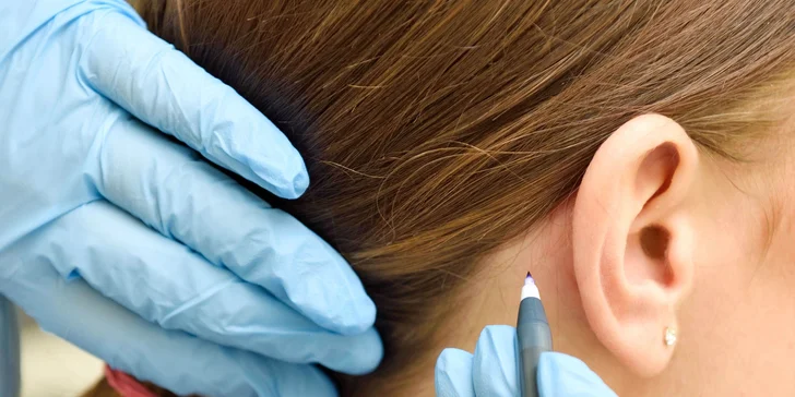 Otoplastika - korekcia uší v privátnom medicínskom centre