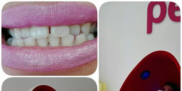 Revolučné expresné bielenie zubov bez peroxidu