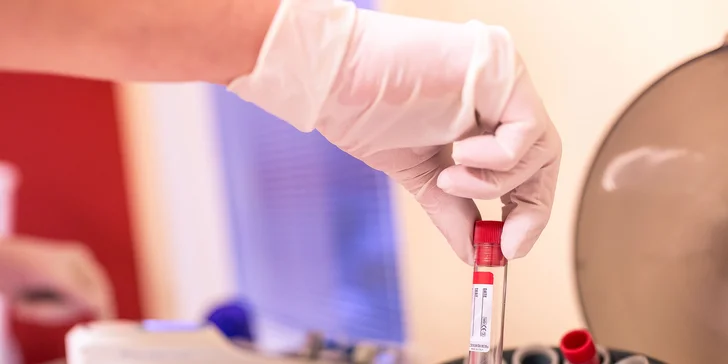 Vitamíny, kyselina hyalurónová či Dracula lift Vital injectorom